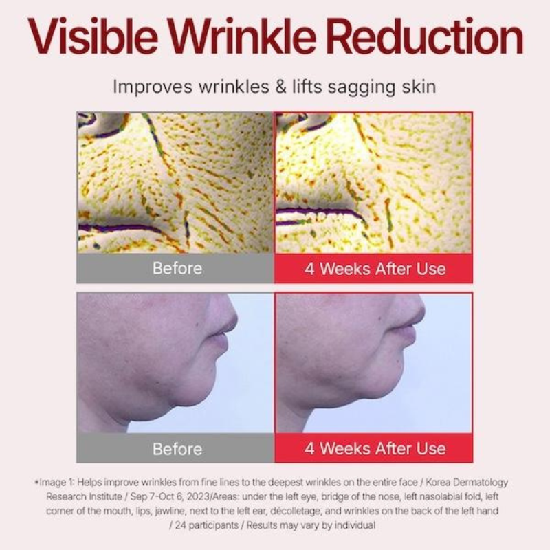 Anti-Aging Moisturizer for Wrinkles & Dry Skin